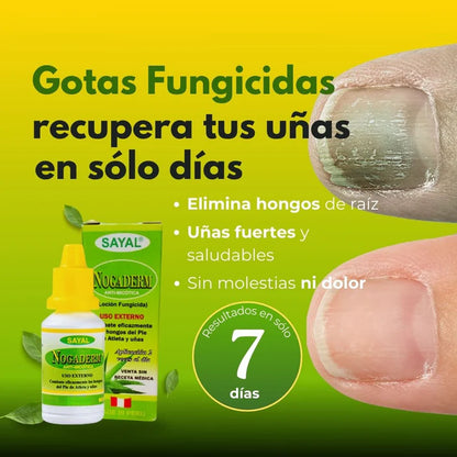 Elimina Hongos, Picazón y Mal Olor — Recupera tus Uñas con Nogaderm®