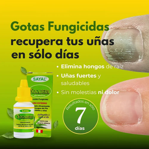 Elimina Hongos, Picazón y Mal Olor — Recupera tus Uñas con Nogaderm®